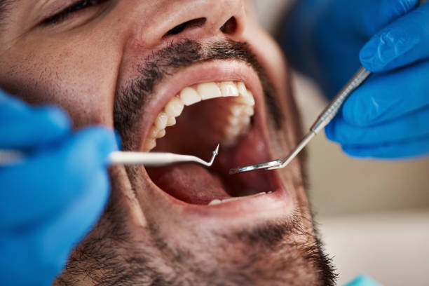 Best Emergency Dentist for Knocked-Out Tooth in Loudoun Lley Estates, VA