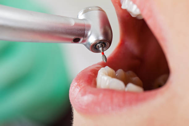 Best Emergency Dentist for Knocked-Out Tooth in Loudoun Lley Estates, VA
